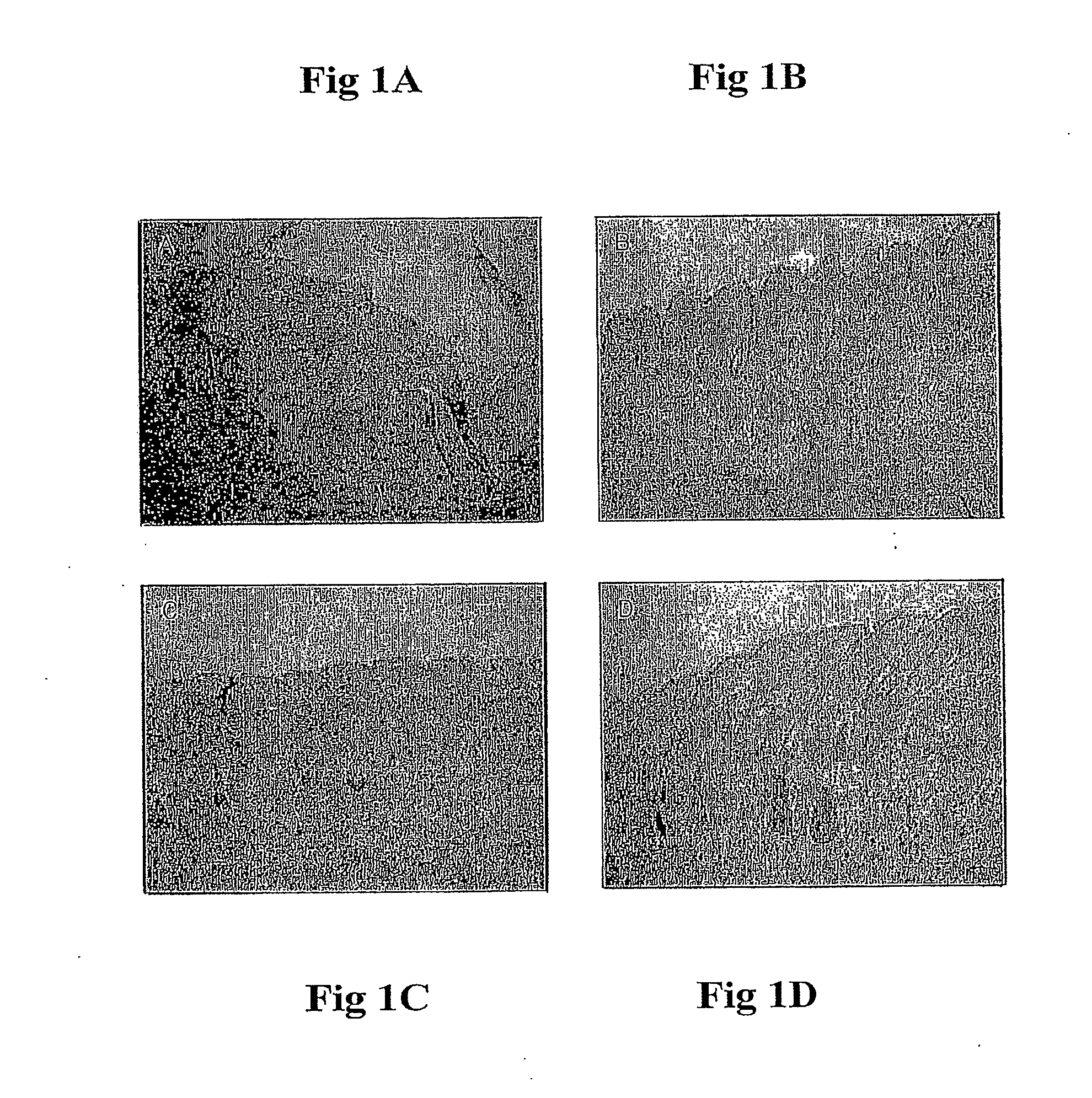 Method and Composition for Burned Skin