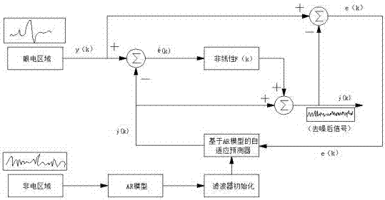 System for screening depressive disorder risk based on sleep electroencephalogram