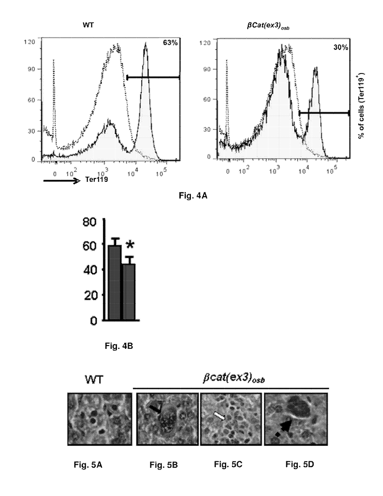 Methods of treating, preventing and diagnosing leukemia and other blood diseases and disorders