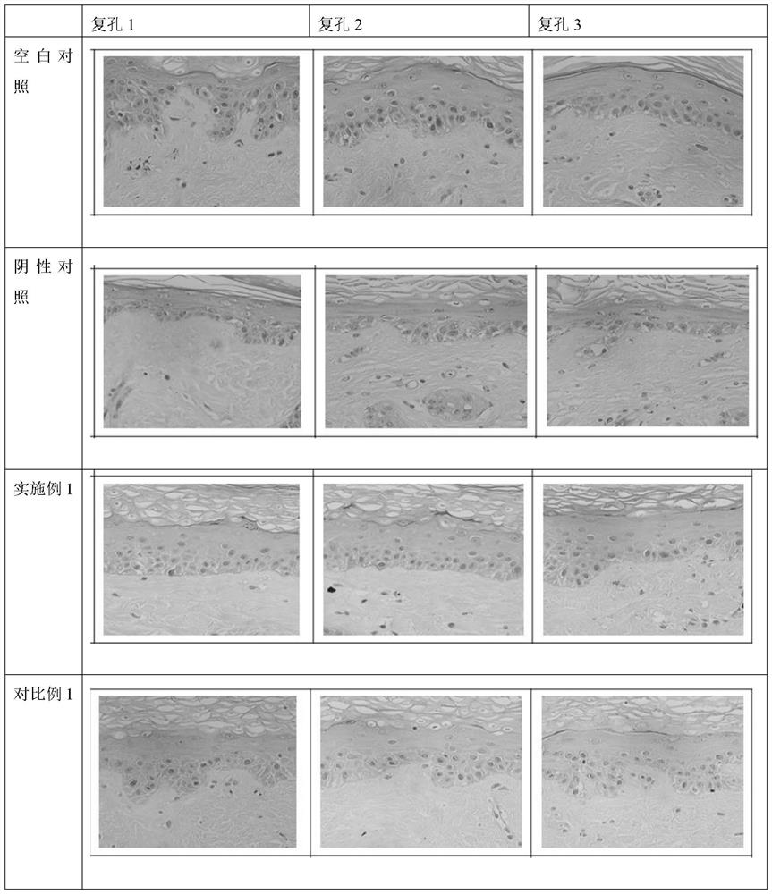 Anti-wrinkle essence and preparation method thereof