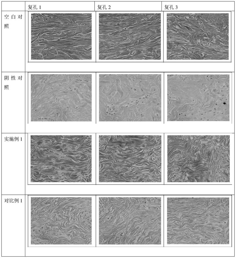 Anti-wrinkle essence and preparation method thereof