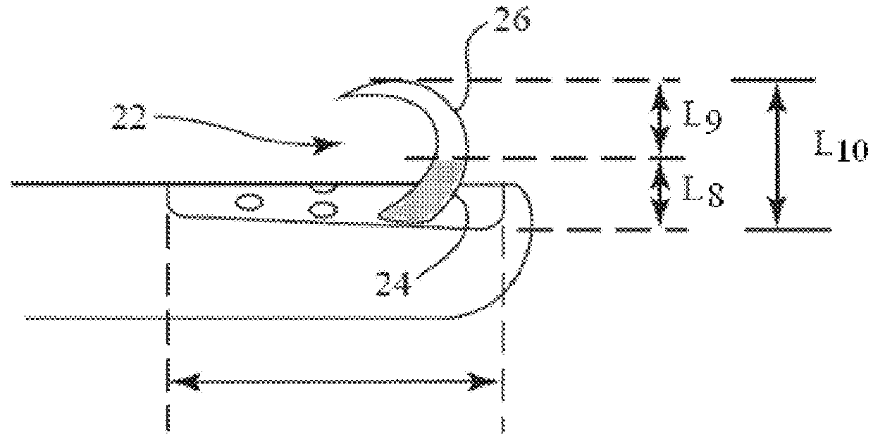 Bladder denervation for treating overactive bladder