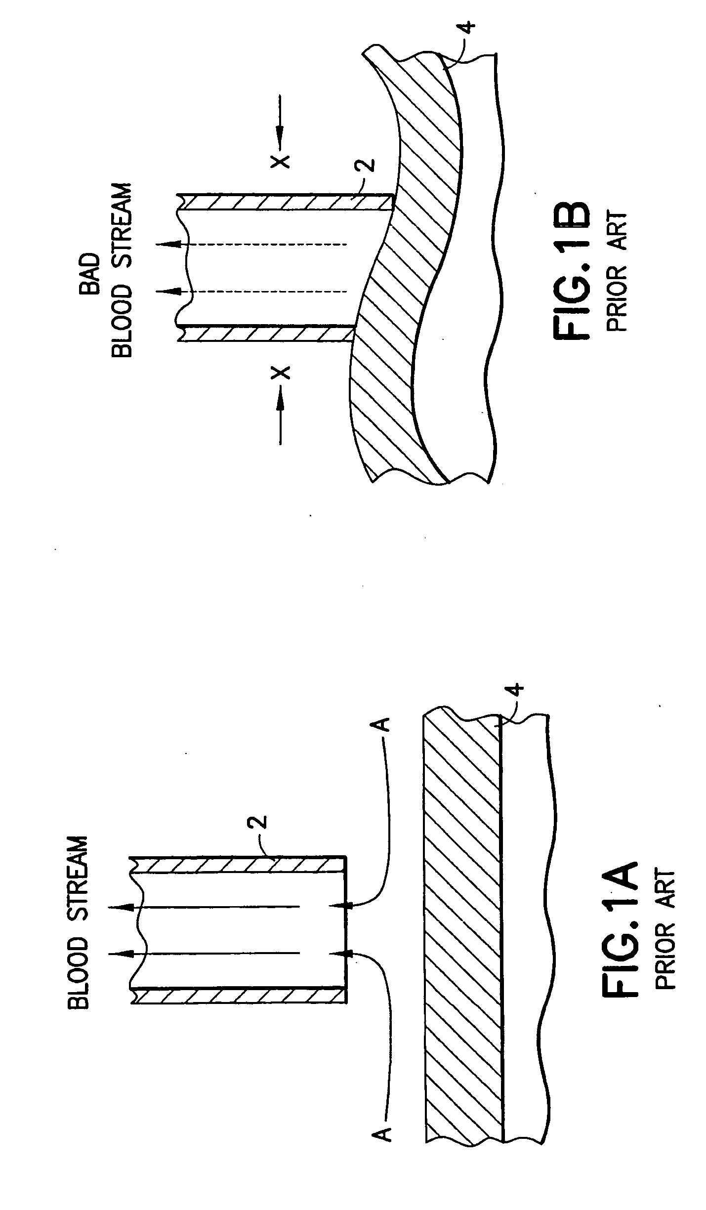 Cannula tip for a cardiac assist device