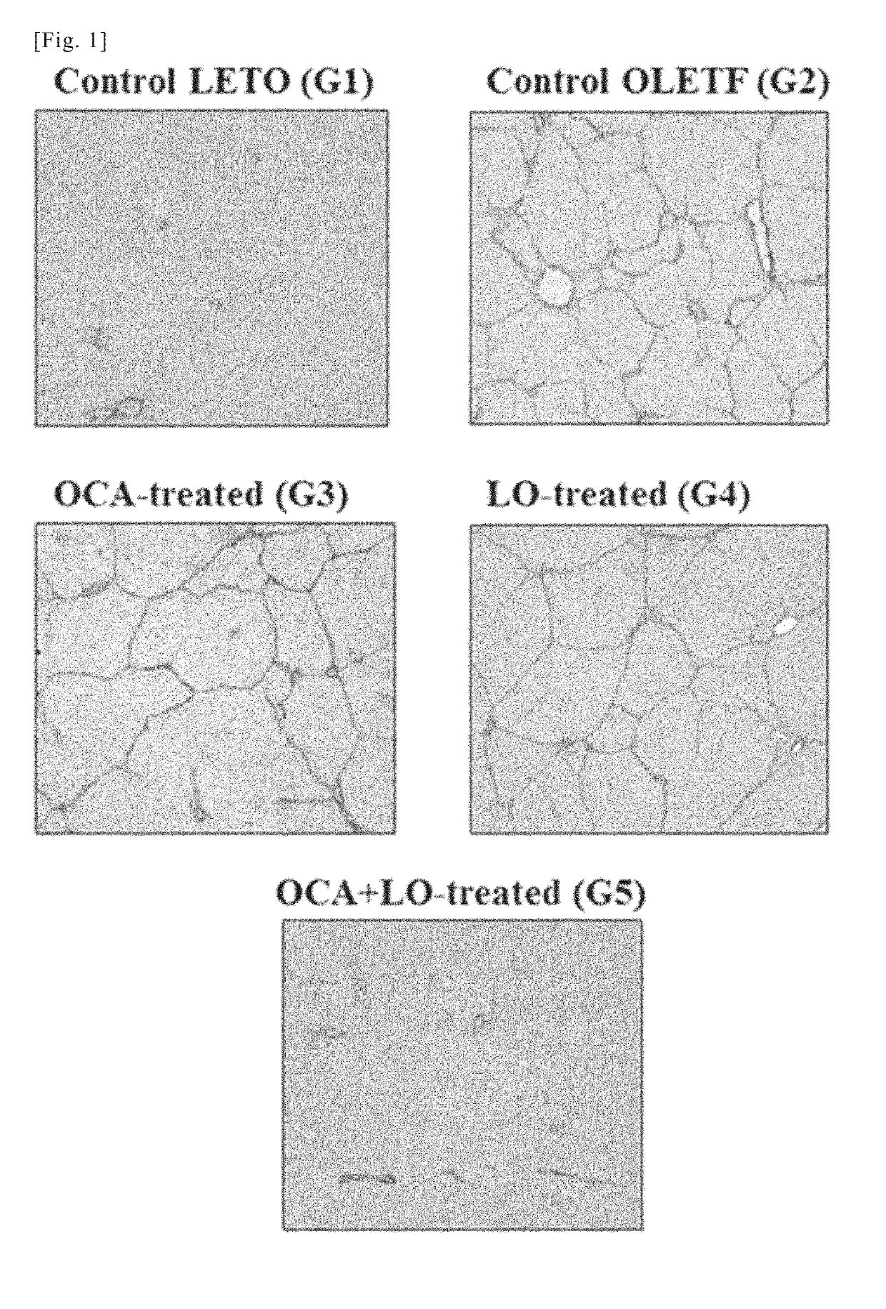 Medicine Obtained by Combining FXR Agonist and ARB