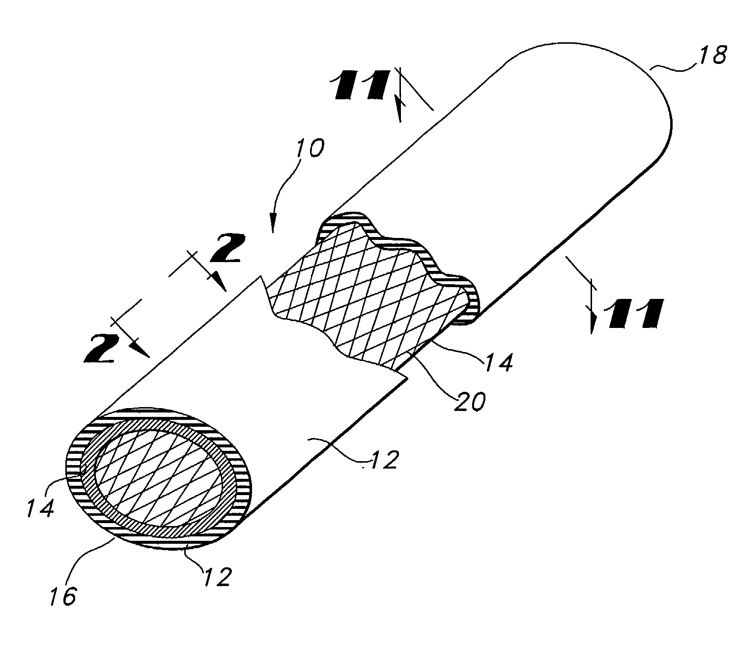 Low profile, high stretch knit prosthetic device