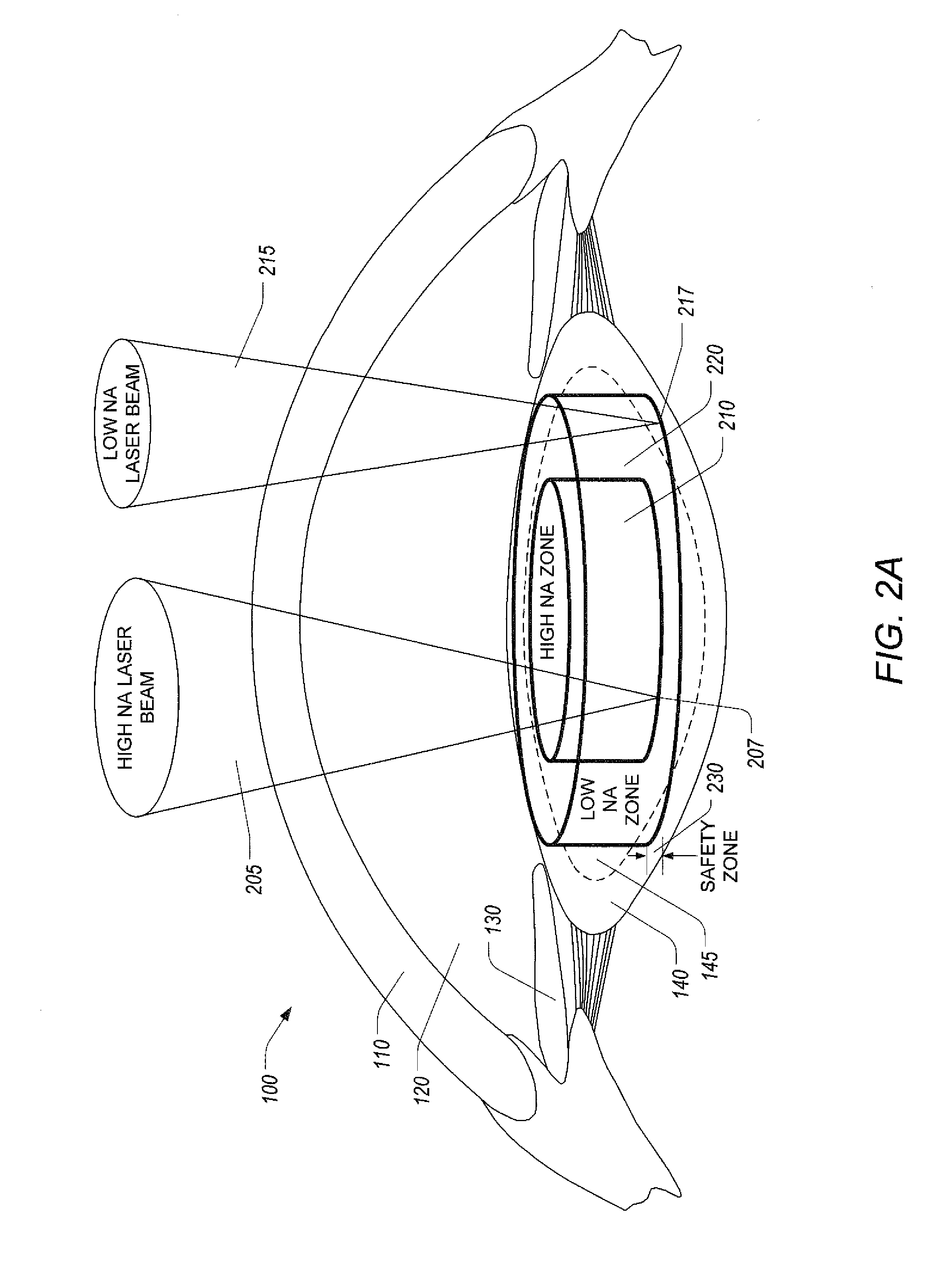 Varying a numerical aperture of a laser during lens fragmentation in cataract surgery