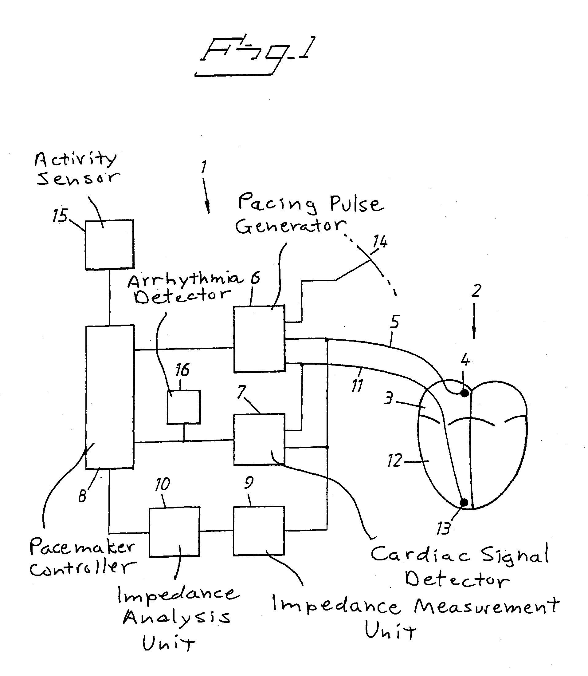 Heart stimulator detecting atrial arrhythmia by determing wall distension by impedance measuring