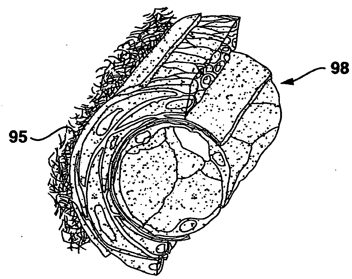 Compliant blood vessel graft