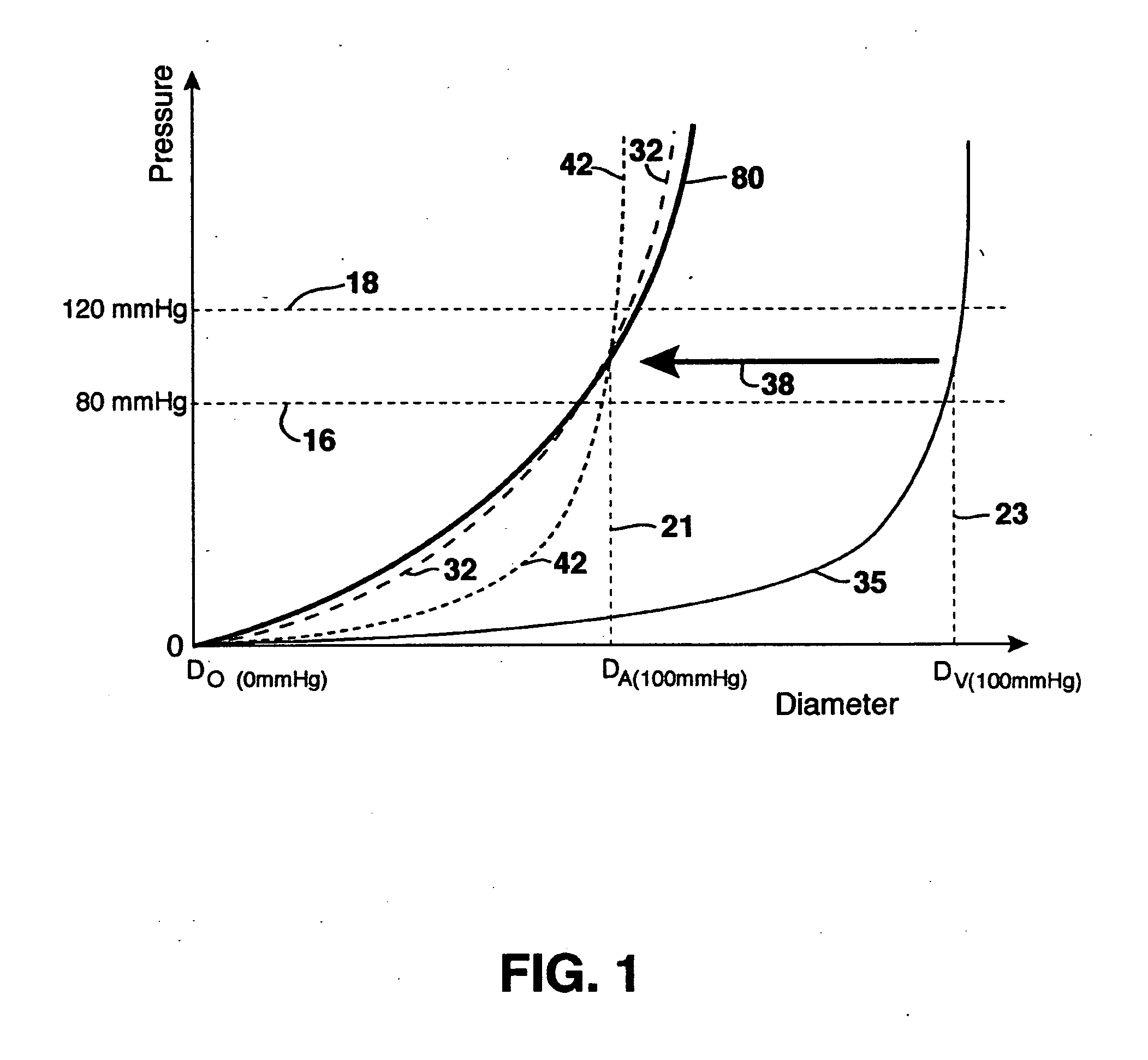 Compliant blood vessel graft