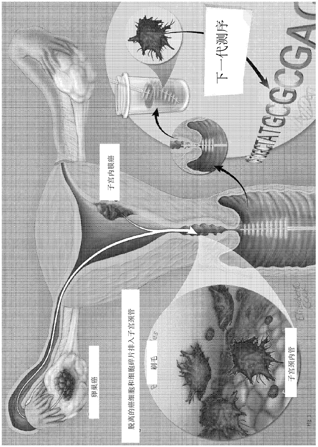 Papanicolaou test for ovarian and endometrial cancers