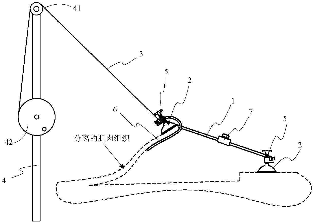 A muscle stretching device