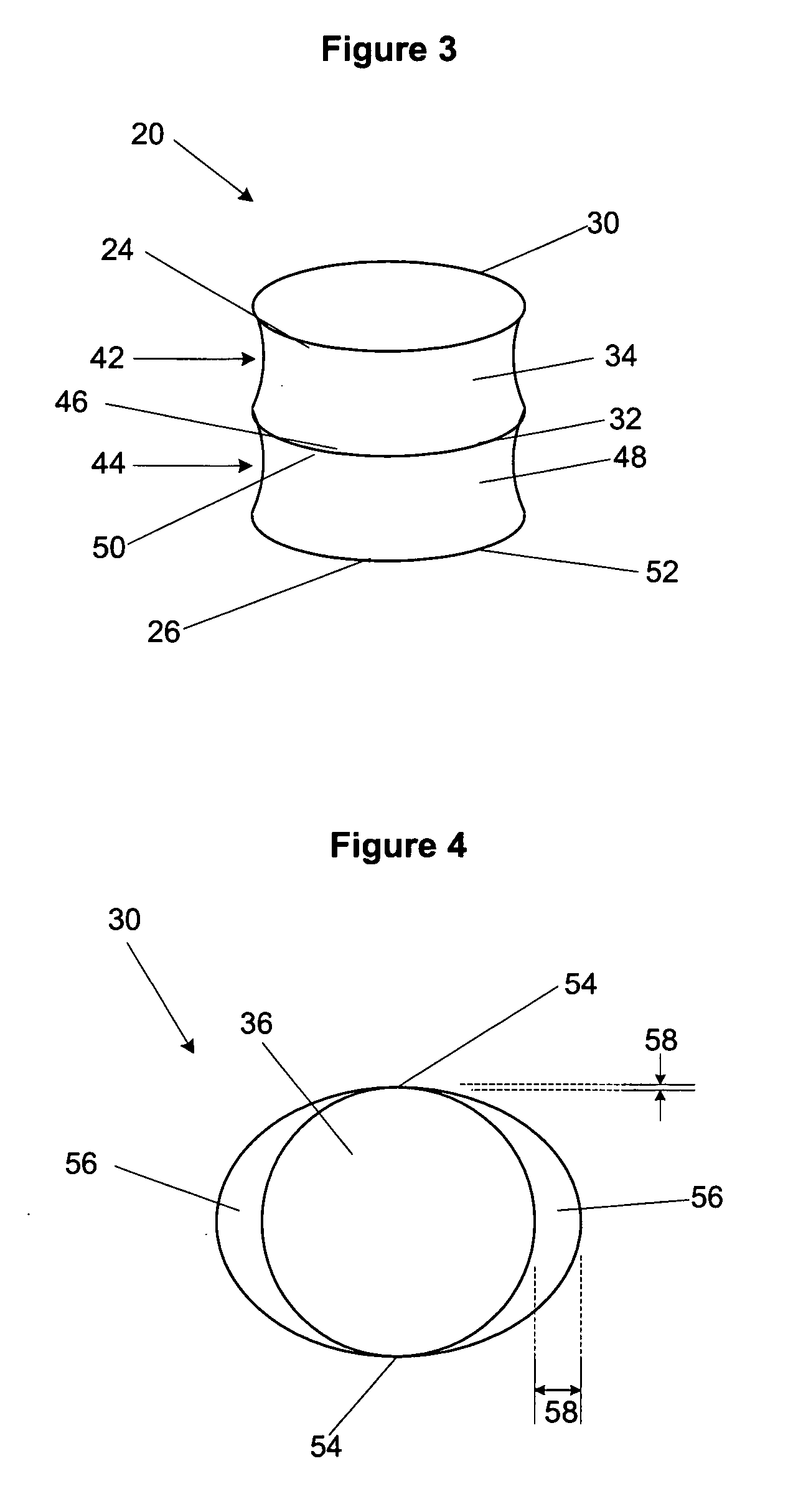 Intravascular implants and methods of using the same