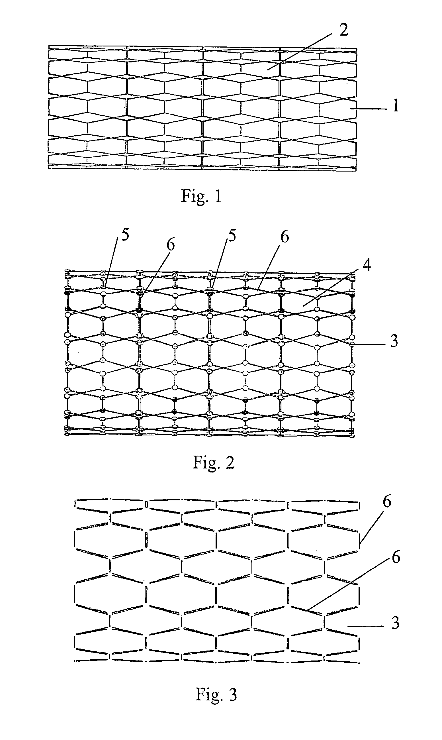 Stent