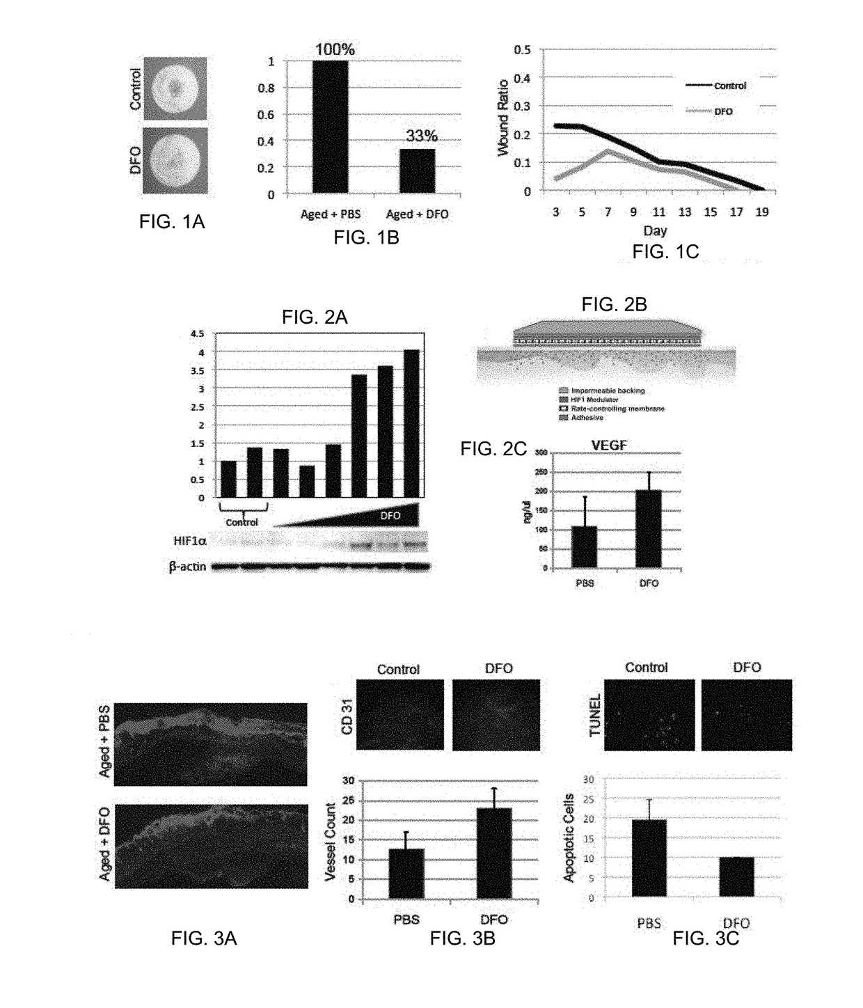 Topical and transdermal delivery of hif-1 modulators to prevent and treat chronic wounds