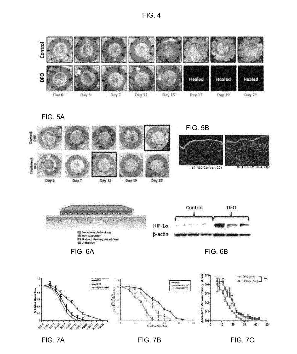 Topical and transdermal delivery of hif-1 modulators to prevent and treat chronic wounds