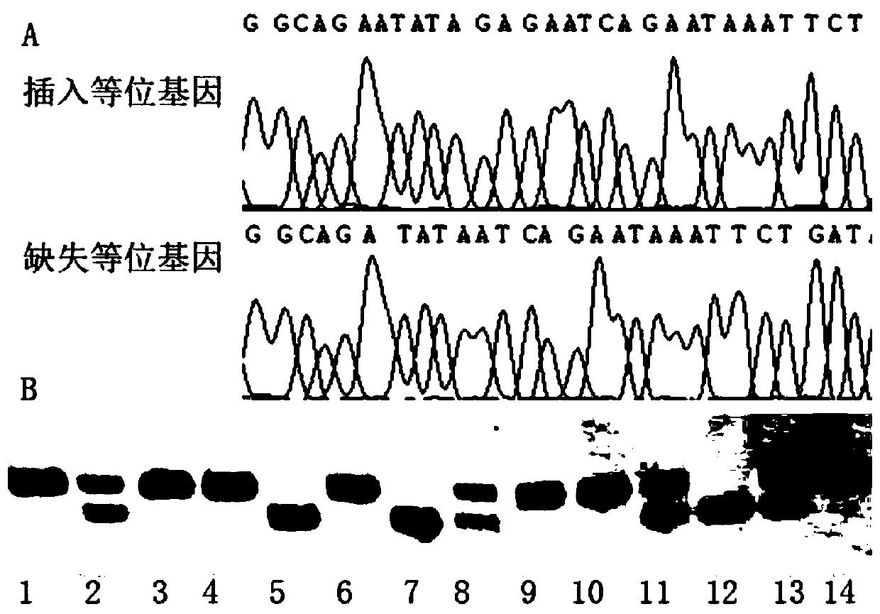 Kit for predicting susceptibility to sudden cardiac death