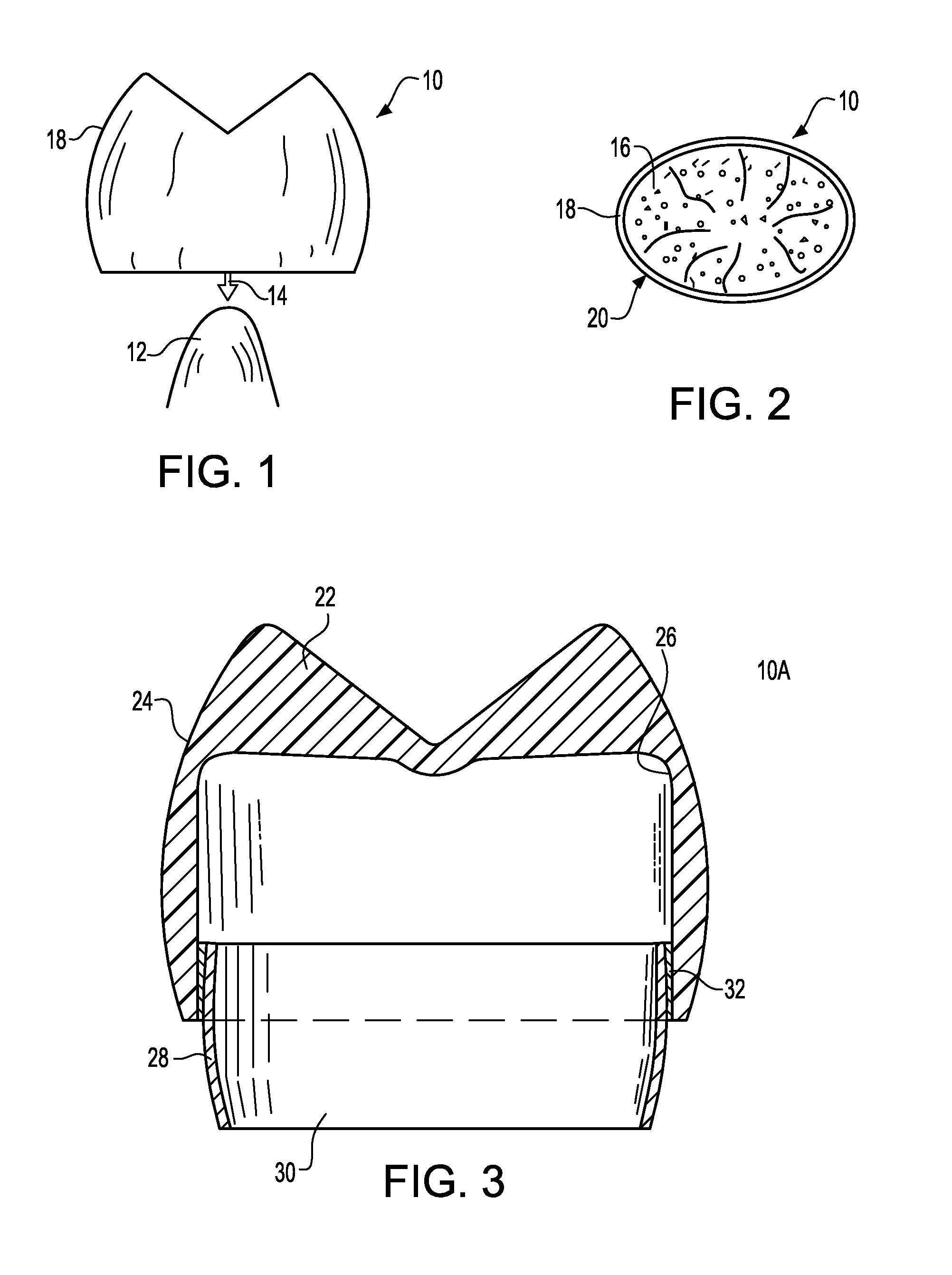 Pedodontic/veterinary dental crown system