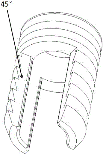 A composite bioactivated anterior cruciate ligament fixation nail