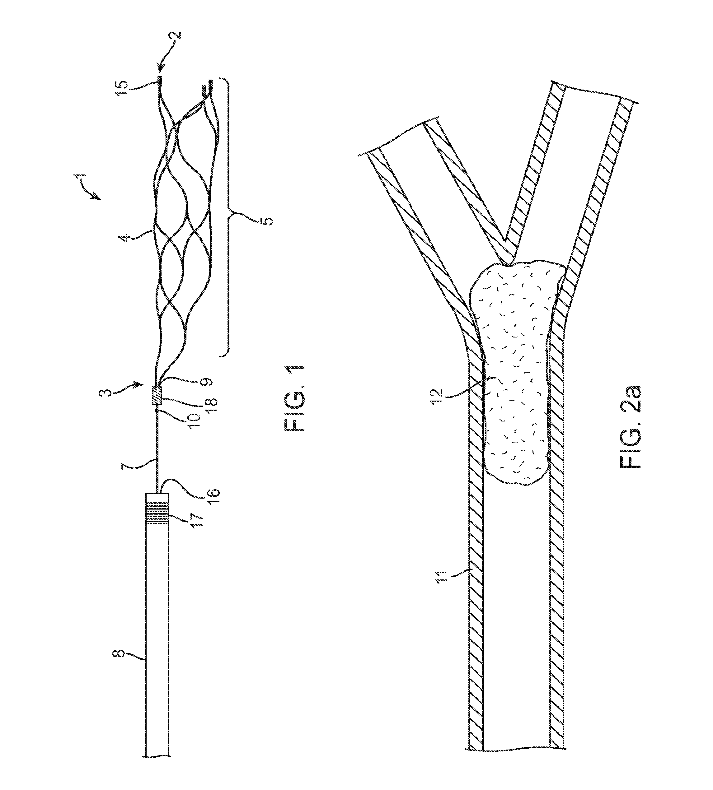 Methods and apparatus for flow restoration