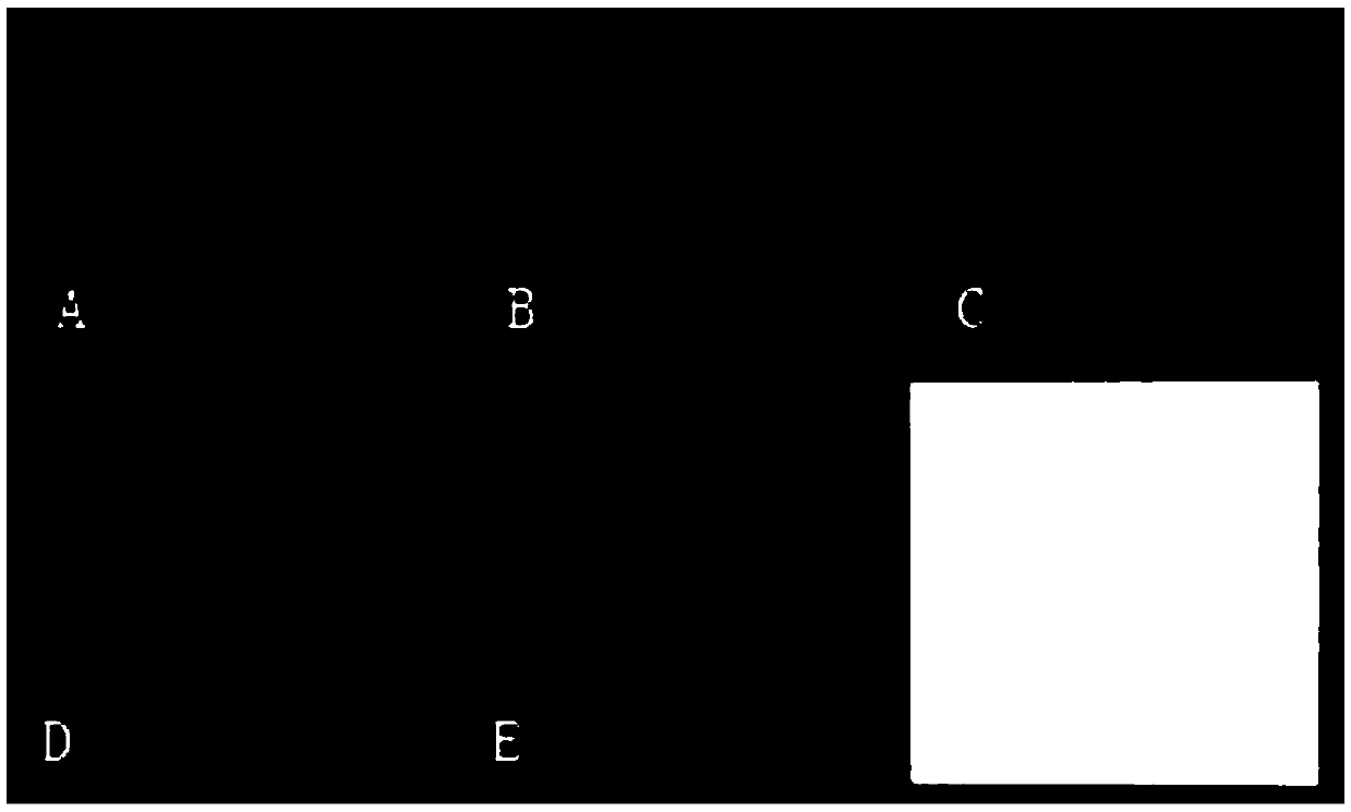 Probe set for IL28B gene polymorphism detection, gene chip and kit