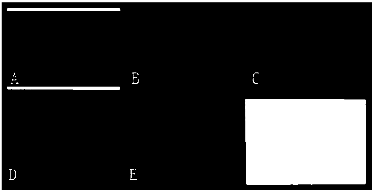 Probe set for IL28B gene polymorphism detection, gene chip and kit