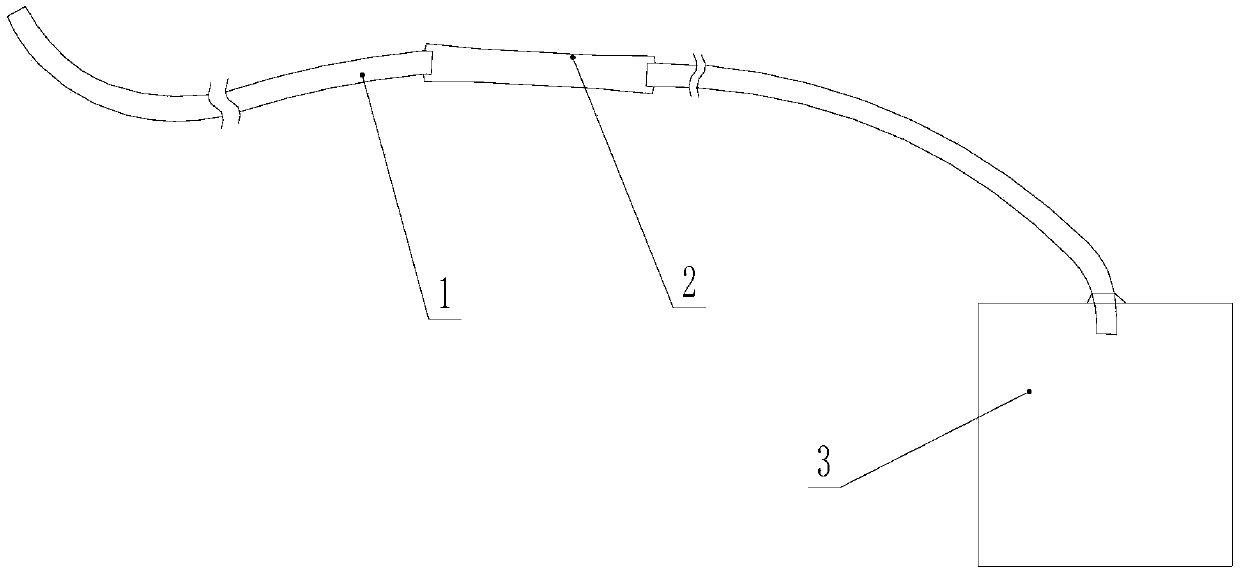 Intra-abdominal effusion drainage device