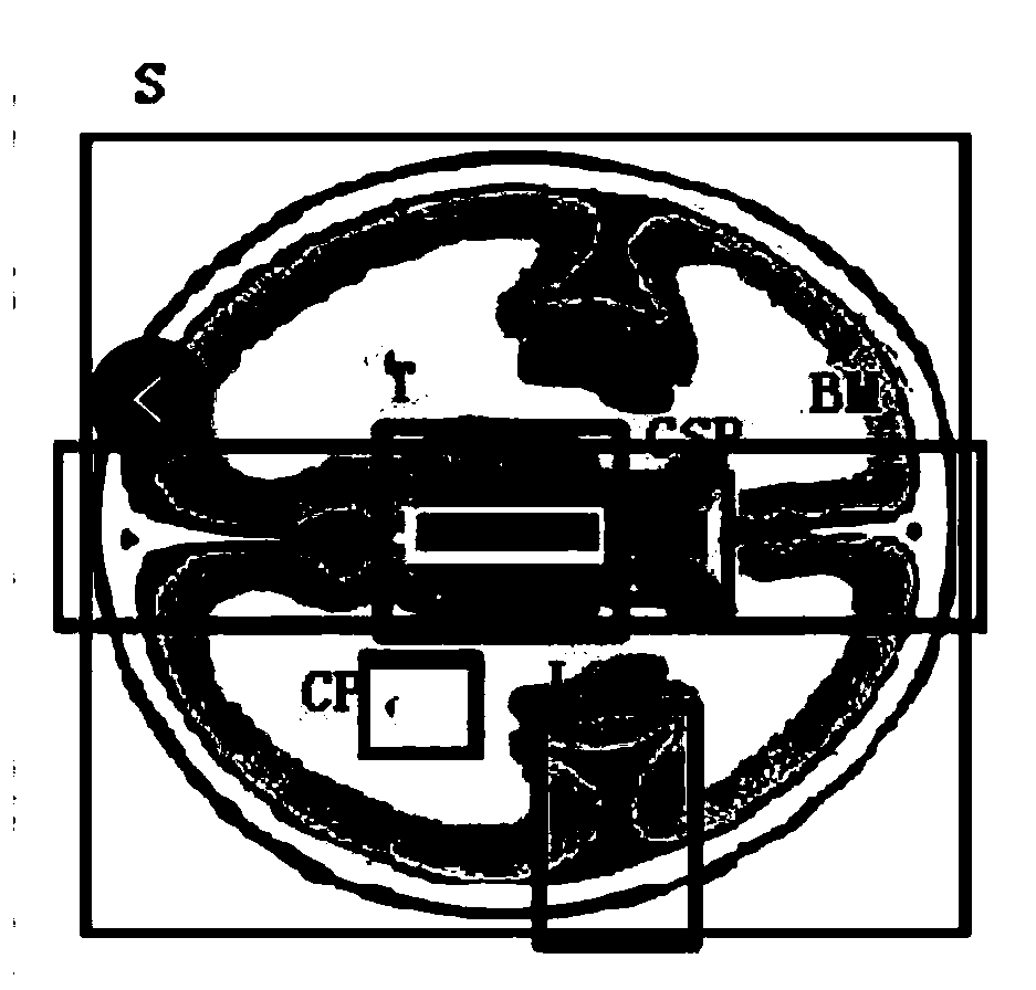 Method for performing quality control on ultrasonic section image of fetus during middle and late pregnancy