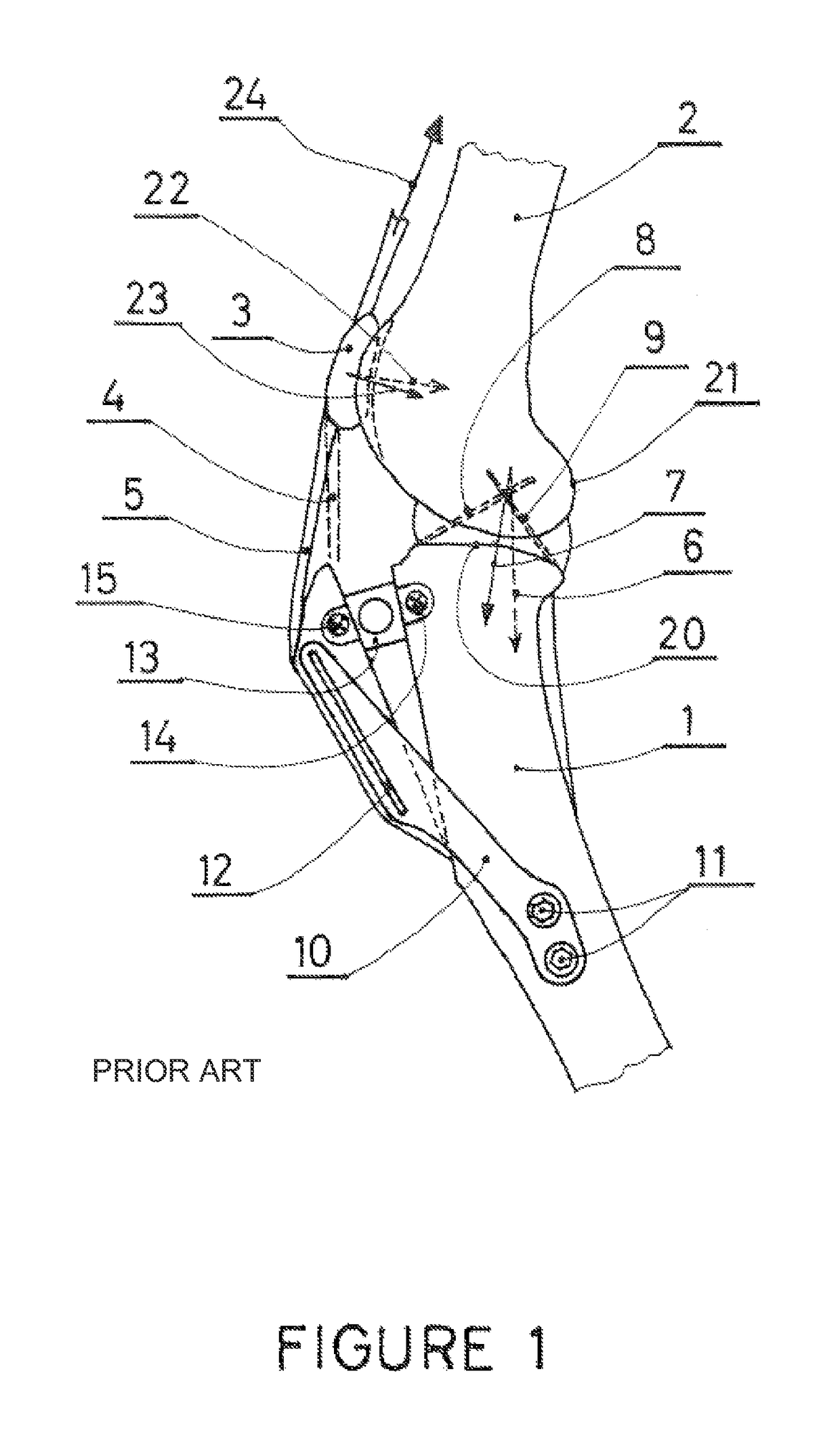 Patellar ligament spacer for ACL injuries