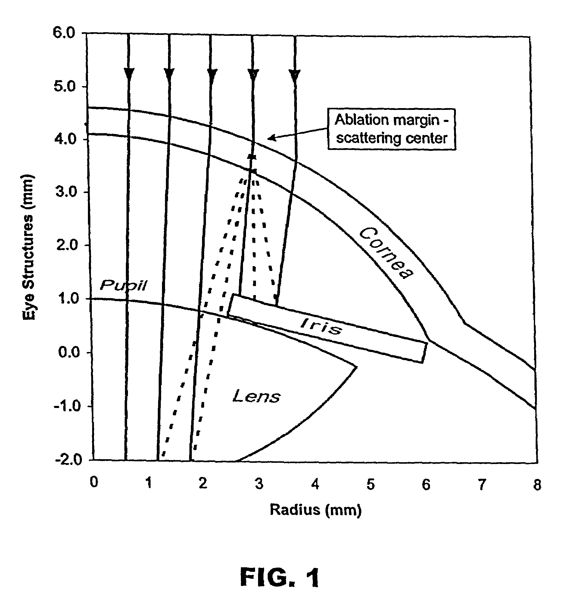 Method and apparatus for reducing visual aberrations