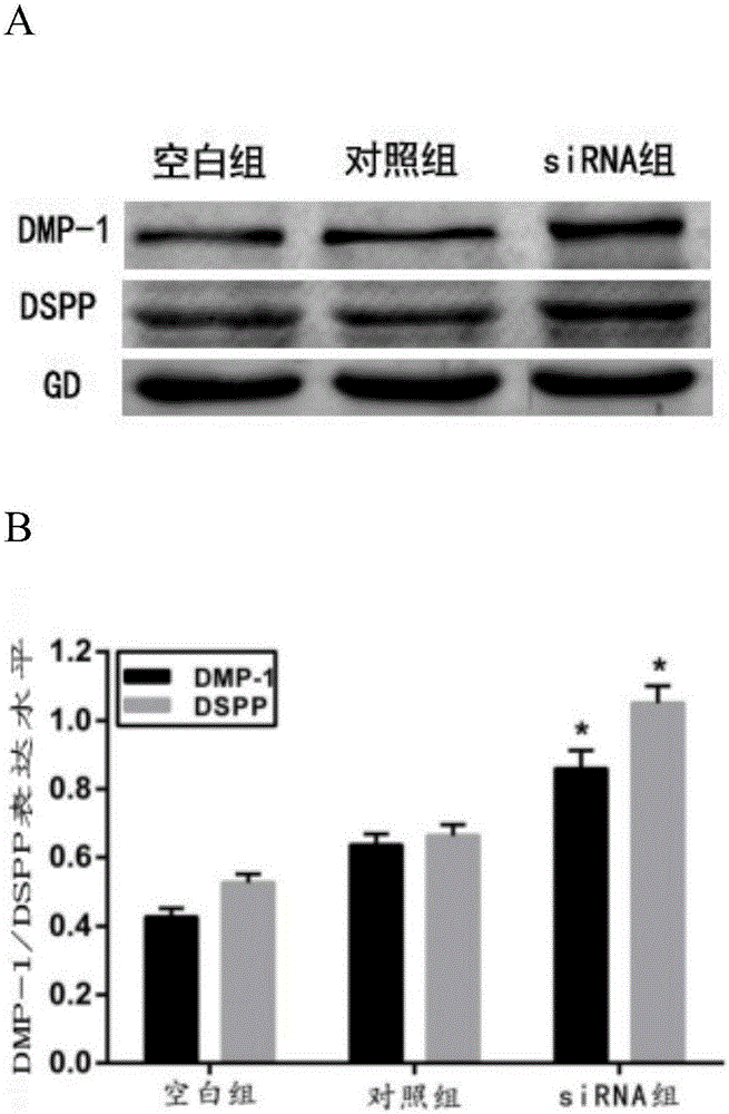 Small interfering RNA of people-targeted IRAK1 gene and application of RNA