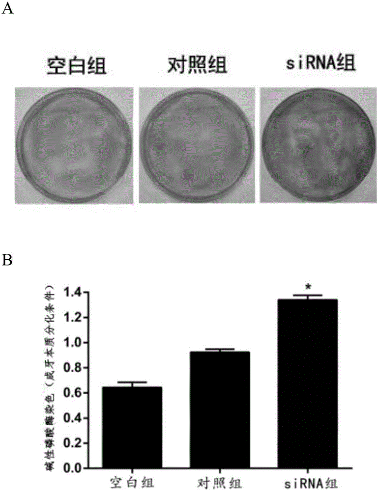 Small interfering RNA of people-targeted IRAK1 gene and application of RNA