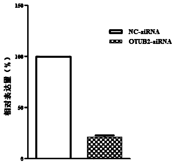 Biology marker for making diagnosis and giving treatment on abdominal aortic aneurysm