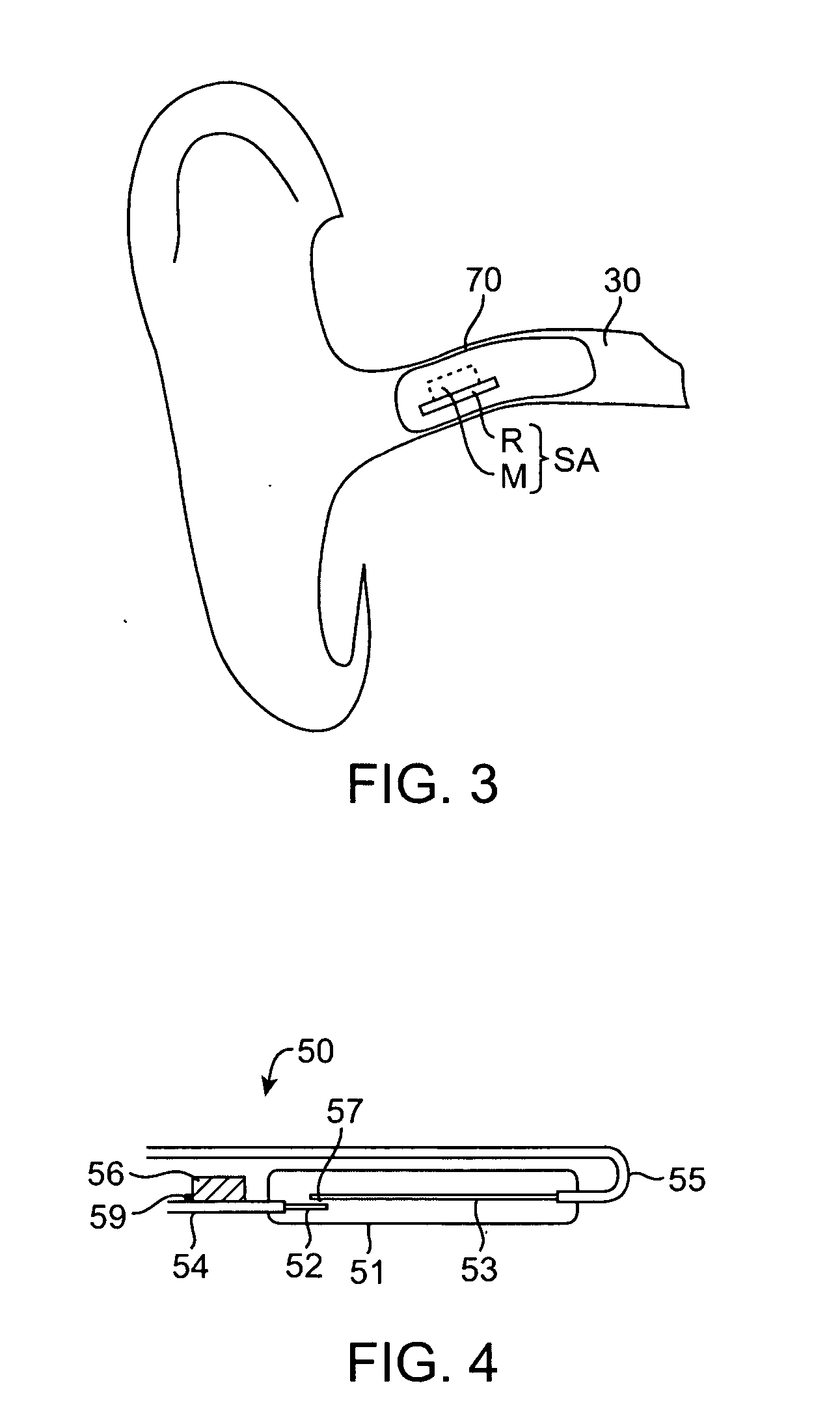 Remote magnetic activation of hearing devices