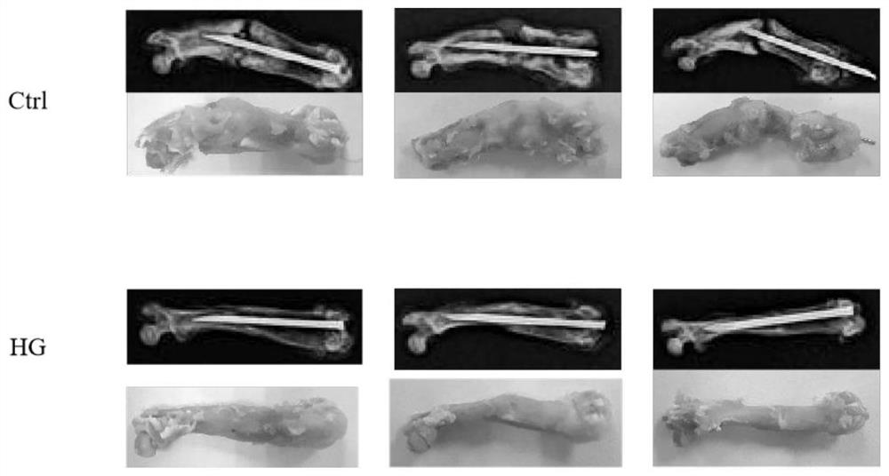 Application of bone protecting capsule as medicine for treating traumatic fracture