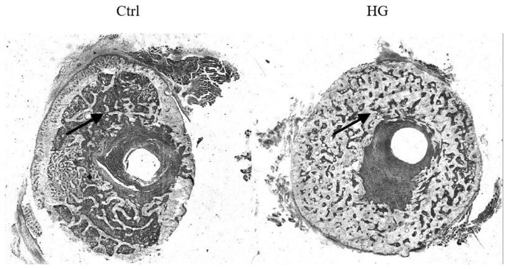 Application of bone protecting capsule as medicine for treating traumatic fracture