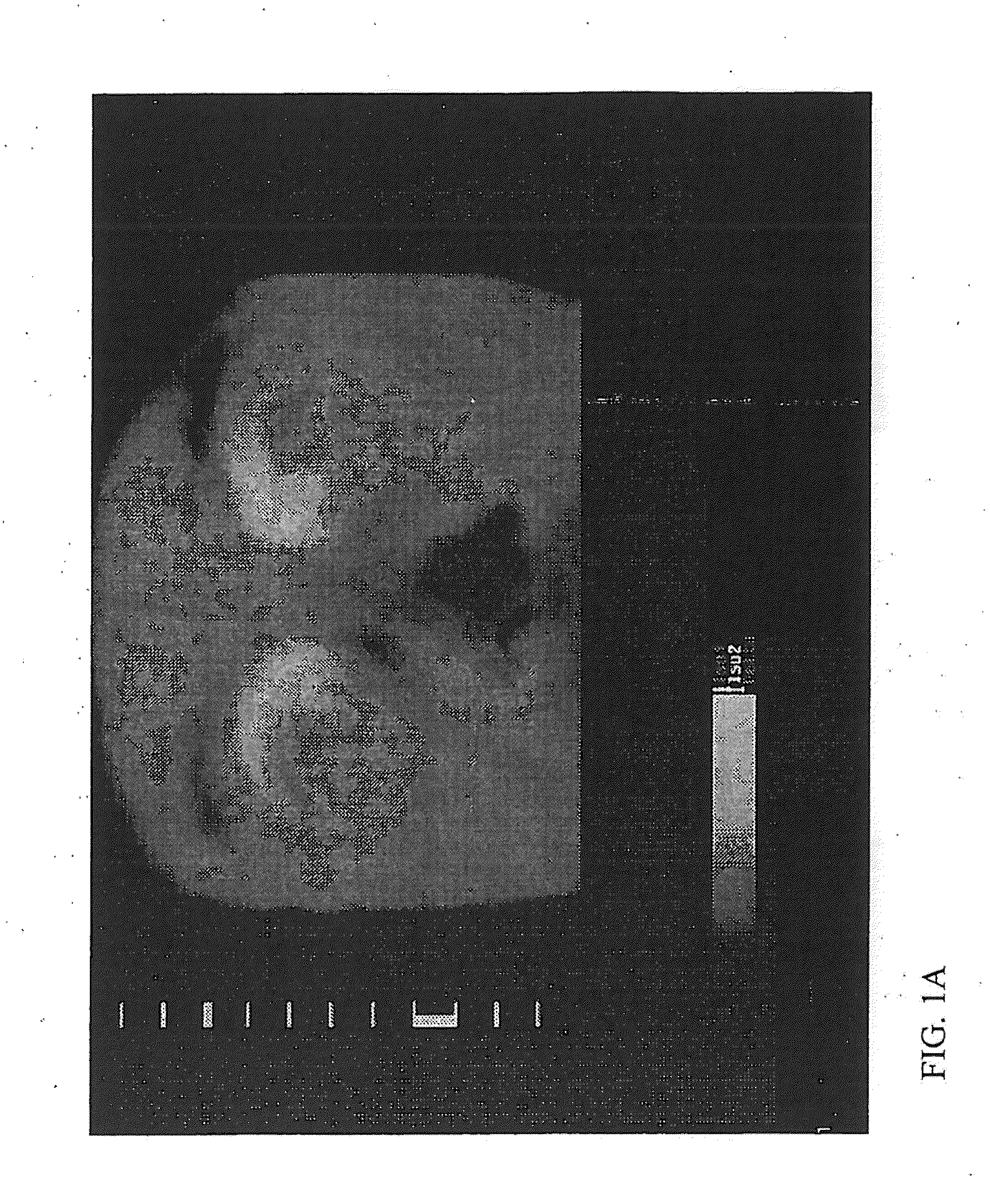 Apparatus and method for measuring biologic parameters