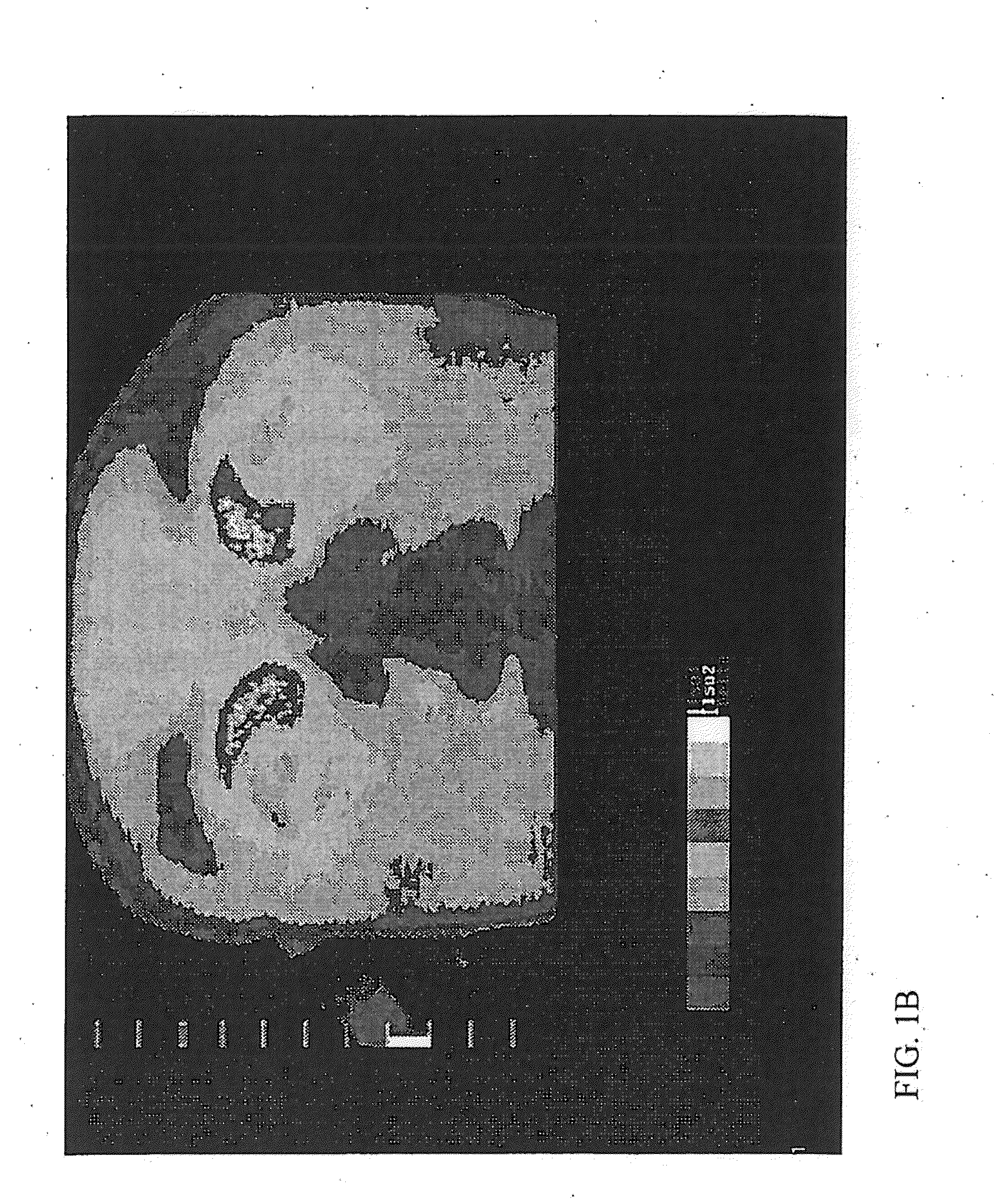 Apparatus and method for measuring biologic parameters