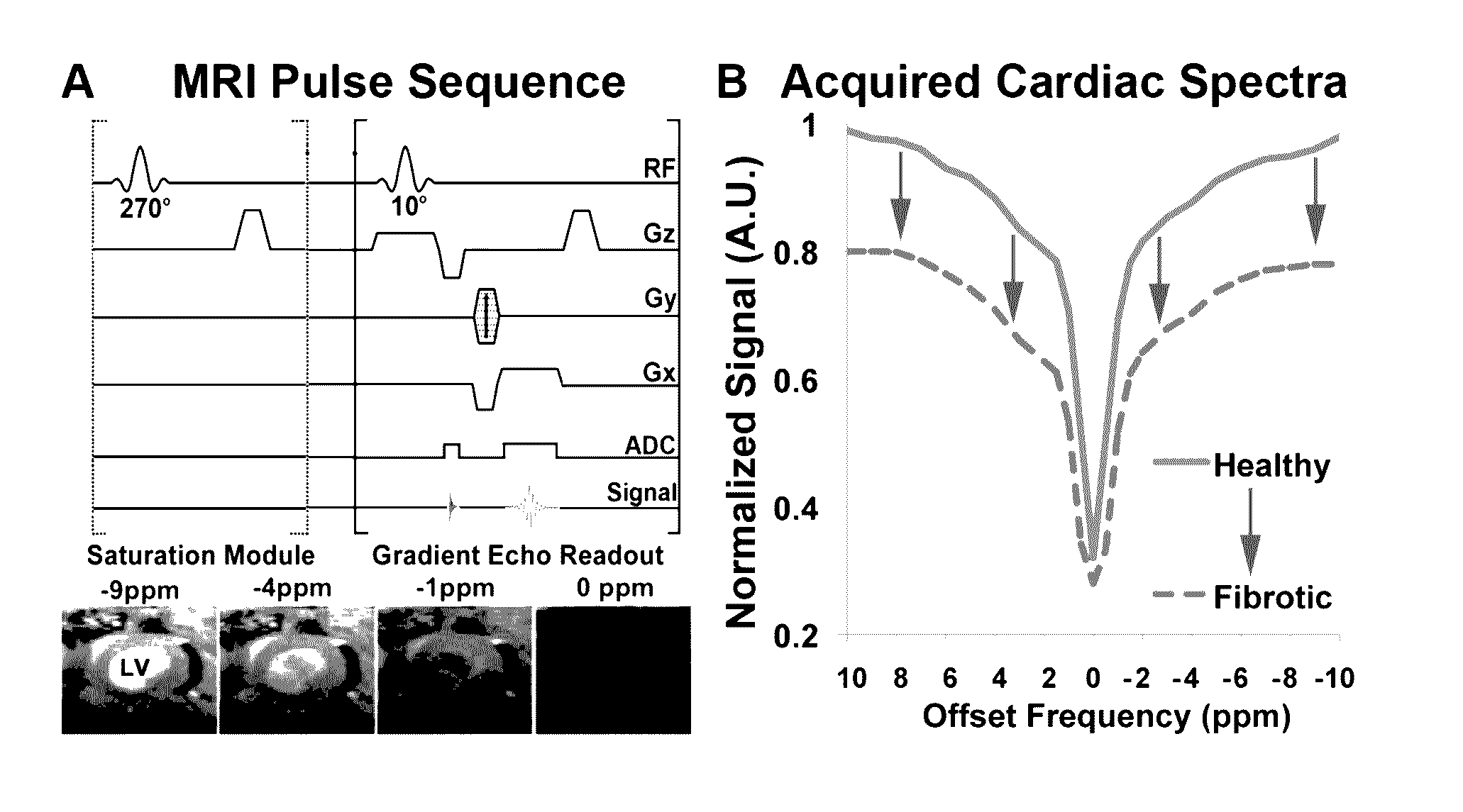 Magnetic resonance imaging for detecting cardiac diseases