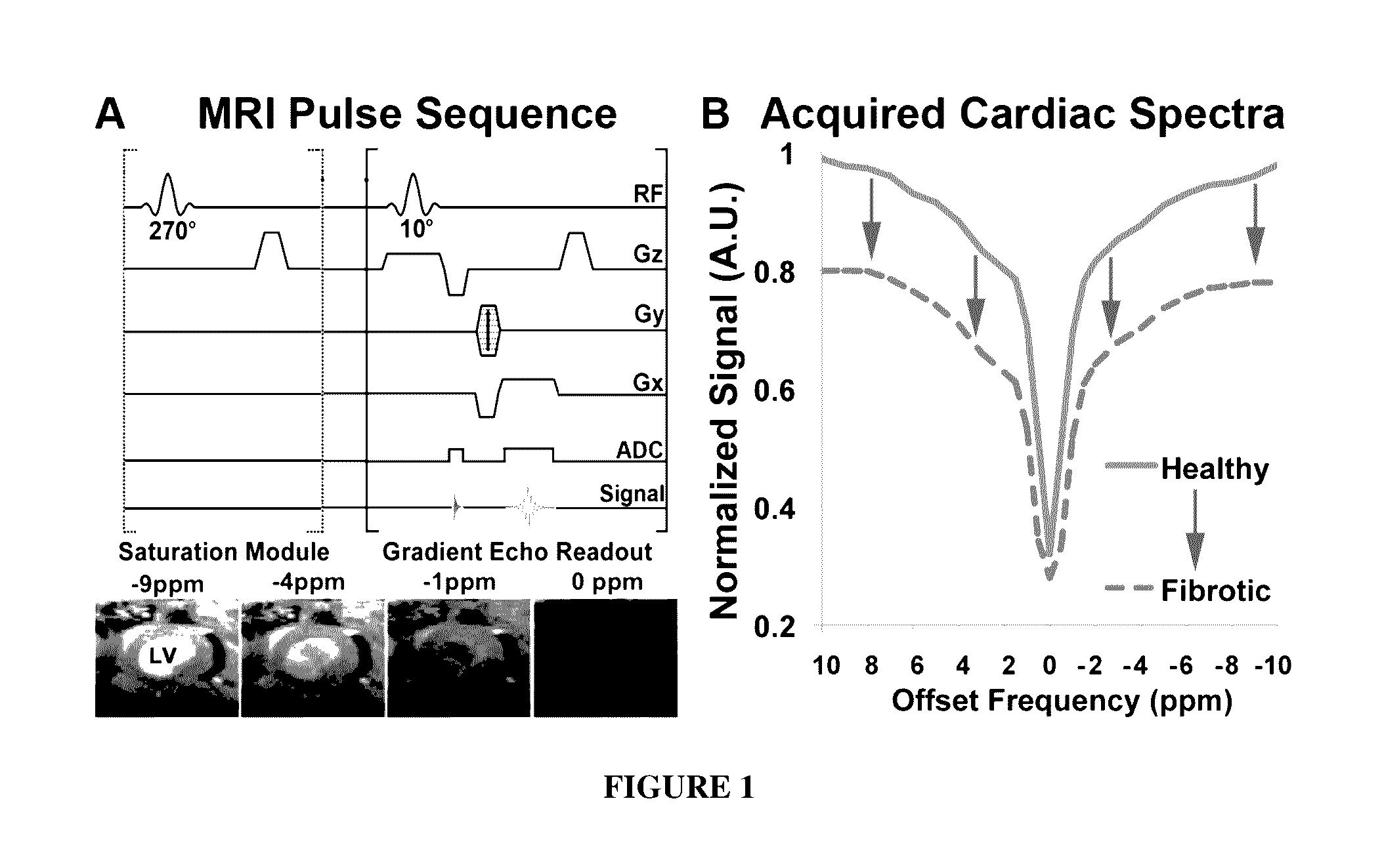 Magnetic resonance imaging for detecting cardiac diseases