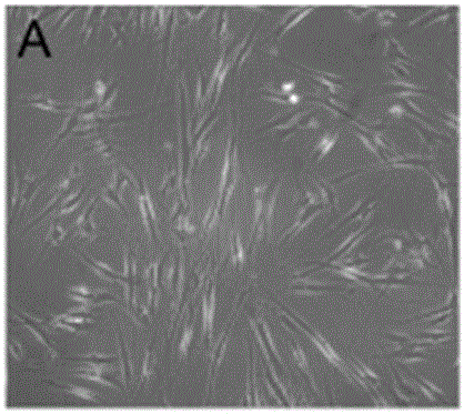 Preparation method of dental pulp stem cell and chitosan scaffold complex