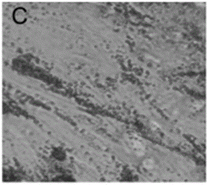 Preparation method of dental pulp stem cell and chitosan scaffold complex