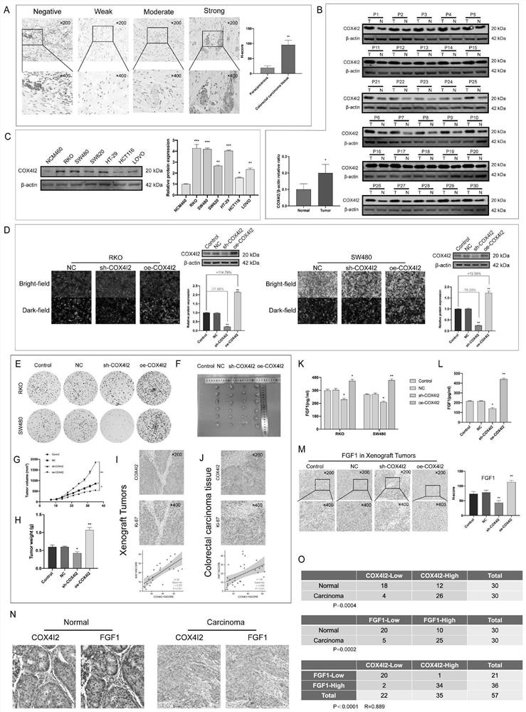 Predictive biomarker for human colorectal cancer or human colorectal cancer metastasis and application of predictive biomarker