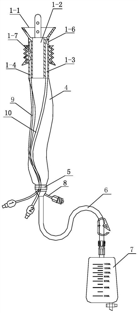 Rectum anastomotic stoma protection device and operation method