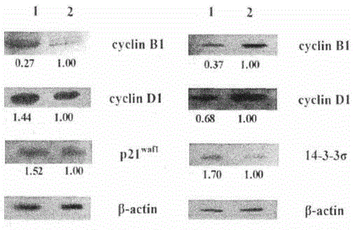 Screening method of esophagus cancer markers by tea polyphenol in tea and golden camellia