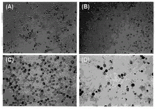 Screening method of esophagus cancer markers by tea polyphenol in tea and golden camellia