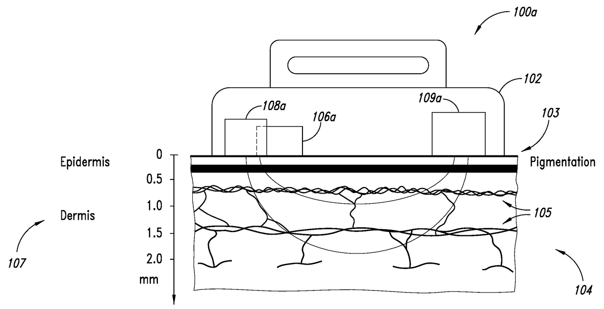 Motion compensation in photopletysmography-based heart rate monitoring