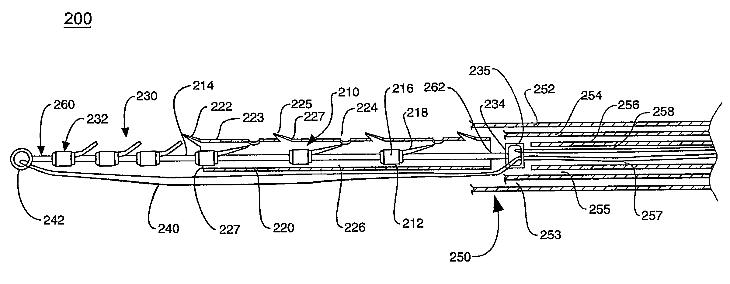 Cardiac valve annulus reduction system