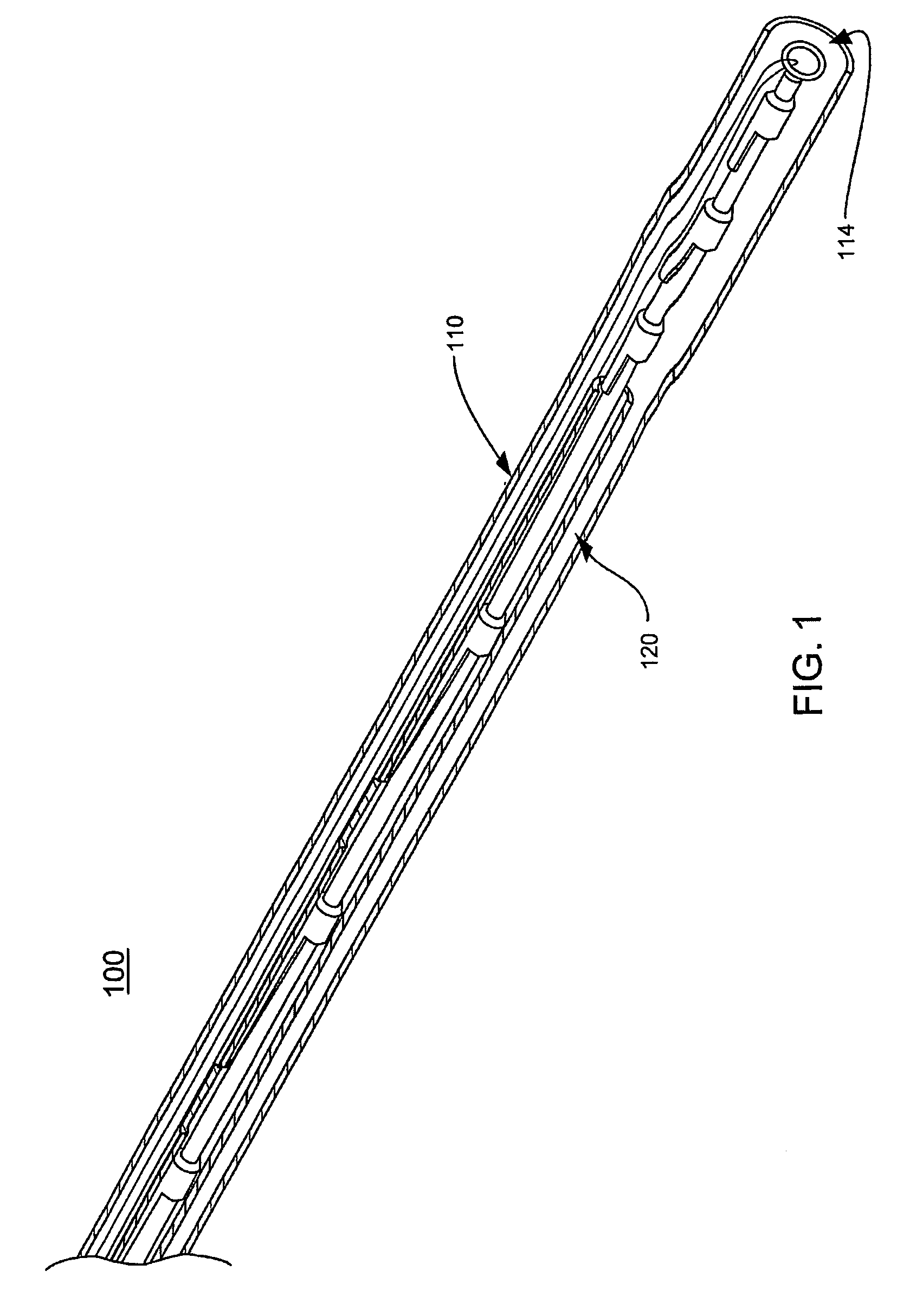 Cardiac valve annulus reduction system