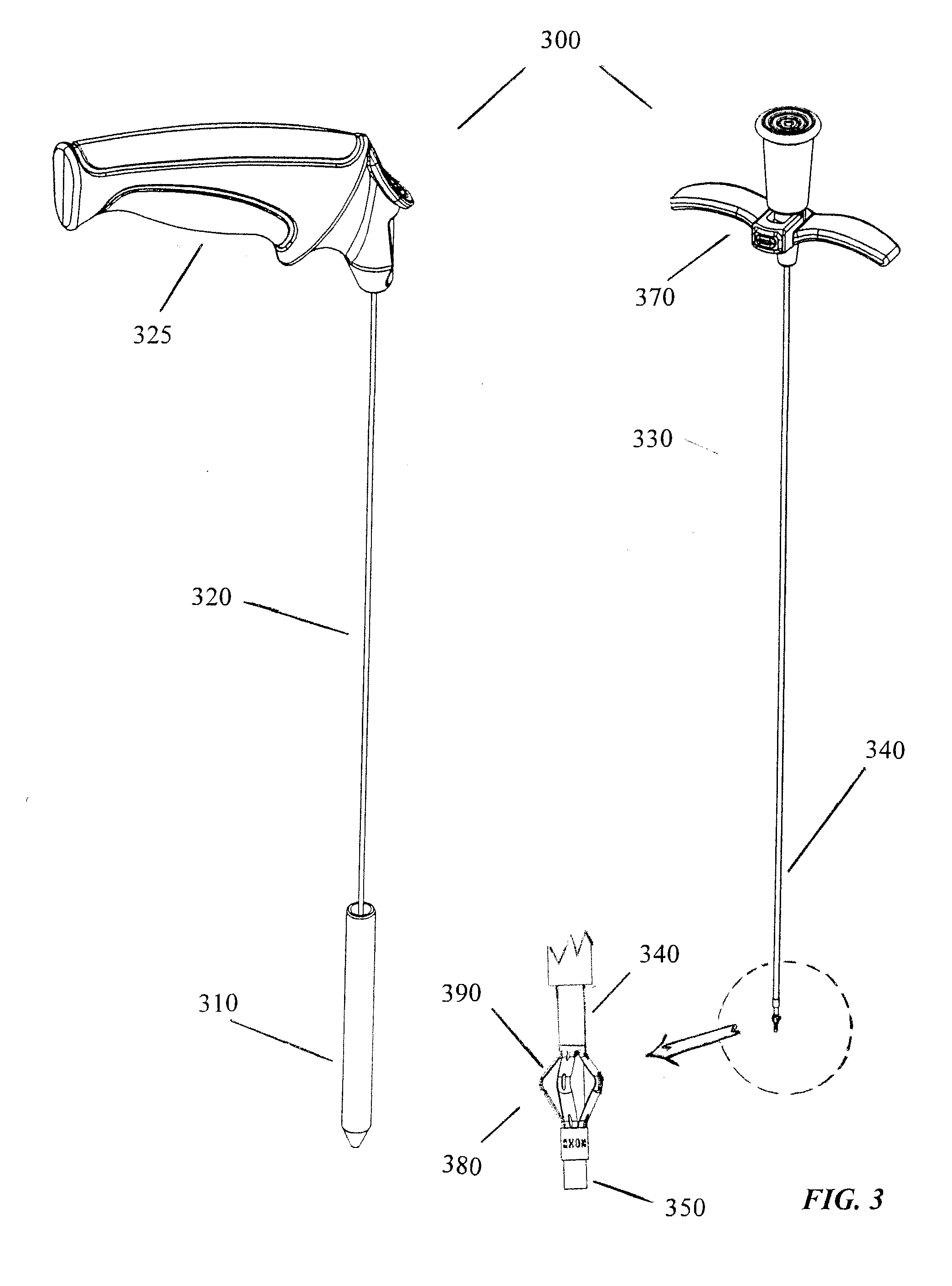 Y-lock tracheal stent system and metod of use