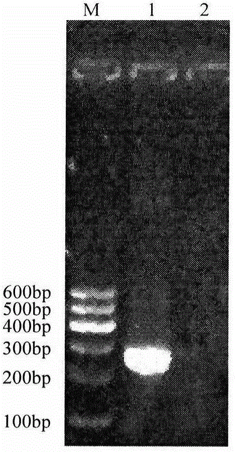 Reverse dot blot hybridization kit for detection of mycobacterium tuberculosis and usage method thereof